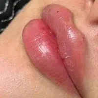 کلینیک سوپر استار سیار زیبایی(در خانه شما)|خدمات آرایشگری و زیبایی|اهواز, شهرک اکباتان|دیوار