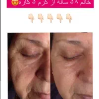 نمایندگی کرم بوتاکس گاتیو(ضدچروک 5کاره|آرایشی، بهداشتی، درمانی|صدرا-فارس, فاز ۲|دیوار