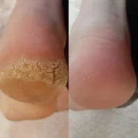 آموزش پدیکور و کفسابی ۹۹۹|خدمات آرایشگری و زیبایی|شاهینشهر, مخابرات (شهید بهشتی)|دیوار