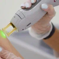 همکاری با دستگاه لیزر شاتی مطب دارای مشتری لیزر