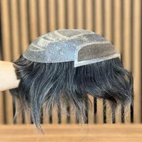 ترمیم و تعمیر پروتز مو|خدمات آرایشگری و زیبایی|تبریز, |دیوار