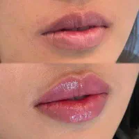 مدل ژل لب رایگان