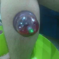 خدمات پرستاری و تزریقات در منزل محمودآباد|خدمات آرایشگری و زیبایی|محمودآباد, |دیوار
