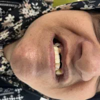 خدمات دندانسازی مروارید|خدمات آرایشگری و زیبایی|دهدشت, |دیوار