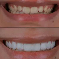 دندانپزشکی طرف قرارداد بیمه و اقساطی|خدمات آرایشگری و زیبایی|شیراز, قصرالدشت|دیوار