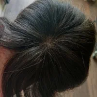 پروتز کف پوستی فرق متحرک