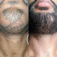 بهش برسی به پرپشتی می‌رسی