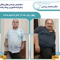 لاغری اسلیو معده دکتر یرانی فوق تخصص با تجربه