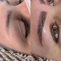 چند برای فیبروز مویی ابرو می‌خوام هزینه مواد 600