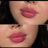 ژل بوتاکس مزو پی آر پی پی ریمو تتو