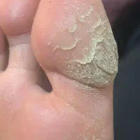 آموزش و خدمات پدیکور