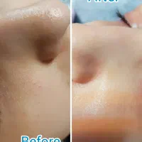 خدمات تخصصی پوست و زیبایی صورت ۵۰٪آف تا فردا|خدمات آرایشگری و زیبایی|مشهد, دانشجو|دیوار
