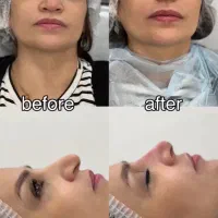 خدمات پوست، مو ، زیبایی|خدمات آرایشگری و زیبایی|تهران, امانیه|دیوار