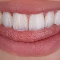 ونیر کامپوزیت لبه شیشه ای|خدمات آرایشگری و زیبایی|ارومیه, |دیوار