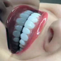 دندانپزشکی تخفیف بازگشایی مدارس با بیمه های تکمیلی|خدمات آرایشگری و زیبایی|اندیشه, اندیشه فاز ۲|دیوار