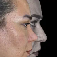 عمل جراحی بینی فقط با ۳۸ تومن با متد پیشرفته|خدمات زیبایی و سلامت|تهران, ونک|دیوار