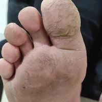 پدیکور و کفسابی|خدمات آرایشگری و زیبایی|قم, بنیاد|دیوار