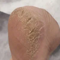 پدیکور و کفسابی