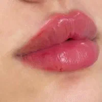 فیلر لب روسی