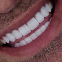 جشنواره کامپوزیت فقط واحدی ۶۹۰هزار|خدمات زیبایی و سلامت|تهران, سازمان برنامه شمالی|دیوار
