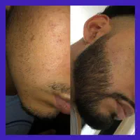 ریش اصالت مرد
