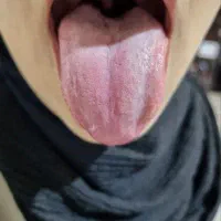 سونوگرافی از روی زبان|خدمات آرایشگری و زیبایی|قم, محمد آباد|دیوار