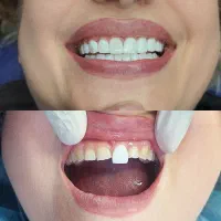 کامپوزیت زیبایی|خدمات آرایشگری و زیبایی|اسلام‌شهر, شهرک قائمیه|دیوار