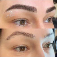 میکروبلیدینگ/ ۲.۰۰۰.۰۰۰/  ماندگاری بالا