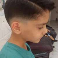 اصلاح موسر صورت ارزان شد150هزار