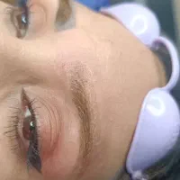 پاک کردن تاتو با دستگاه کیوسویچ پیکشور پرو