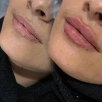 آف ۳۰% ژل بوتاکس بایوفیلر پی ارپی لاغری هایفو لیزر|خدمات آرایشگری و زیبایی|اهواز, کوی باهنر|دیوار