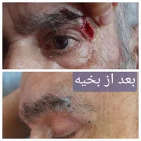 ختنه،جراحی سرپایی شرق|خدمات آرایشگری و زیبایی|دماوند, دماوند|دیوار