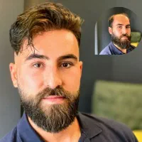 پروتز مو معجزه زیبایی|خدمات آرایشگری و زیبایی|اصفهان, ملک|دیوار