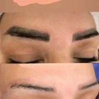 ریمو تتو صورت