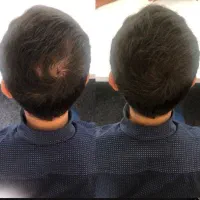 زیبایی رو به خودت هدیه بده