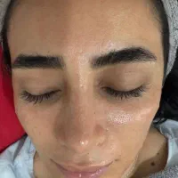 فیشیال تخصصی با بهترین برندو متریال کره ای|خدمات آرایشگری و زیبایی|رامهرمز, |دیوار
