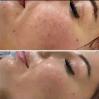 خدمات تخصصی پوست در محدوده ولیعصر|خدمات آرایشگری و زیبایی|تهران, بلوار کشاورز|دیوار