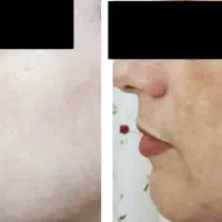 محصولات ضدلک|آرایشی، بهداشتی، درمانی|قم, آرامستان بهشت معصومه|دیوار