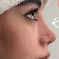 دکتر بینی خوب بهم معرفی کنید