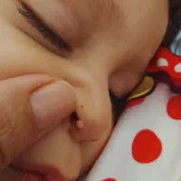 حذف خال ،زگیل فقط با قطره|خدمات آرایشگری و زیبایی|سبزوار, غرب نیروگاه|دیوار