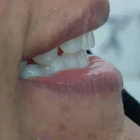 ساخت دندان و دندان سازی قدیری|خدمات آرایشگری و زیبایی|یزد, |دیوار