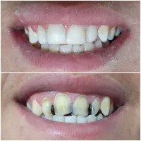 دندانپزشکی دانش ، کیفیت عالی ، نقد و اقساط|خدمات آرایشگری و زیبایی|قرچک, مهدیه|دیوار