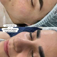 فیشال تخصصی با تخفیف ویژه