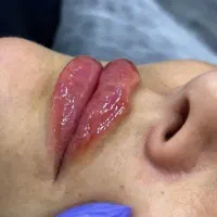 آف ژل بوتاکس مناسبت روز زن|خدمات آرایشگری و زیبایی|ایذه, |دیوار