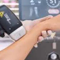 لیزر موهای زائد فیشیال