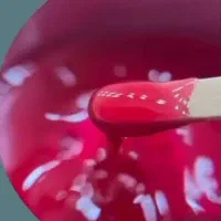 اپیلاسیون تخصصی