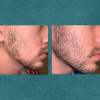 تیغ نزن|آرایشی، بهداشتی، درمانی|یاسوج, |دیوار