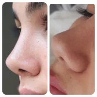 فیشیال اموزش مراقبت پوست پاکسازی ،کار ویژه یلدا|خدمات آموزشی|اصفهان, شاهزاده ابراهیم|دیوار