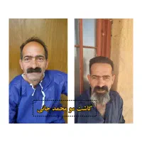 کاشت مو و ابرو و ریش|خدمات آرایشگری و زیبایی|ارسنجان, |دیوار