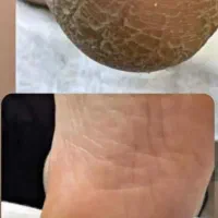 کفسابی پدیکور پا جوانسازی دست|خدمات آرایشگری و زیبایی|سبزوار, فرهنگیان|دیوار